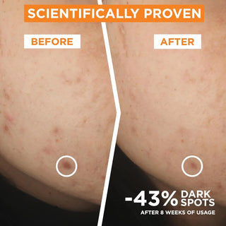 Garnier Skin Active Vitamin C Brightening Serum - Serum