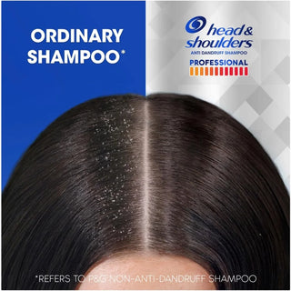 Head & Shoulders Professional Severe Dandruff Advanced Oil Control Shampoo - 300ml - Shampoo