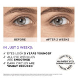 L’Oréal Paris Revitalift Filler Eye Serum - Eye Cream