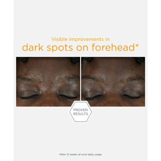 Neostrata Enlighten 15% Vitamin C + PHA Serum - Serum