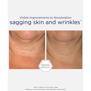 Neostrata Skin Active Triple Firming Neck Cream - Neck Cream