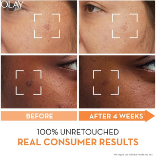 Olay Let’s Glow Together Gift Set - Skin Care Pack