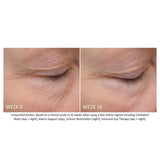 Neostrata Skin Active Intensive Eye Therapy - Eye Cream
